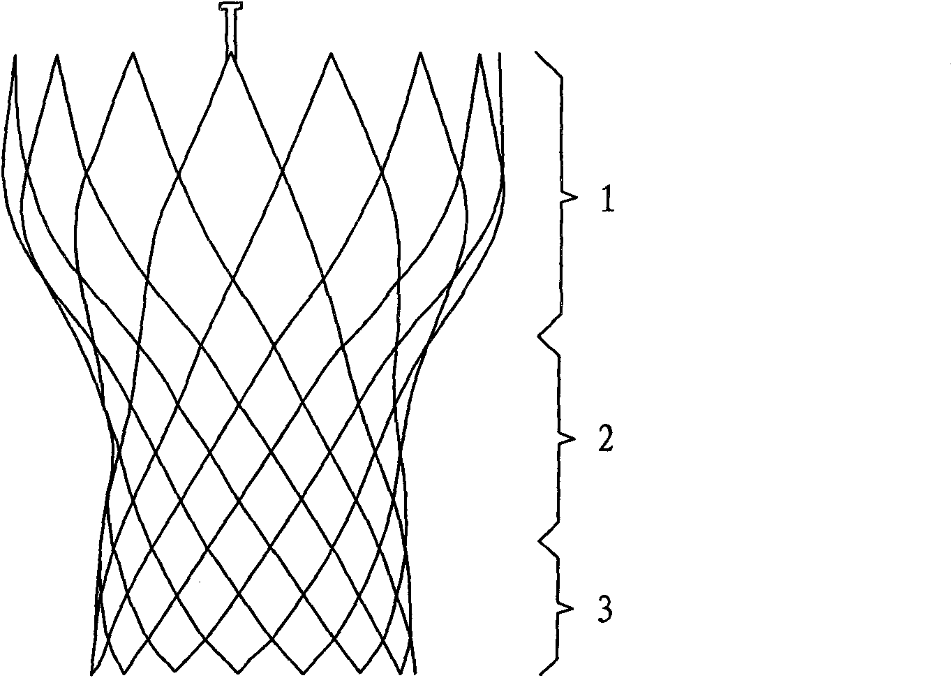 Artificial valve displacement device and stent