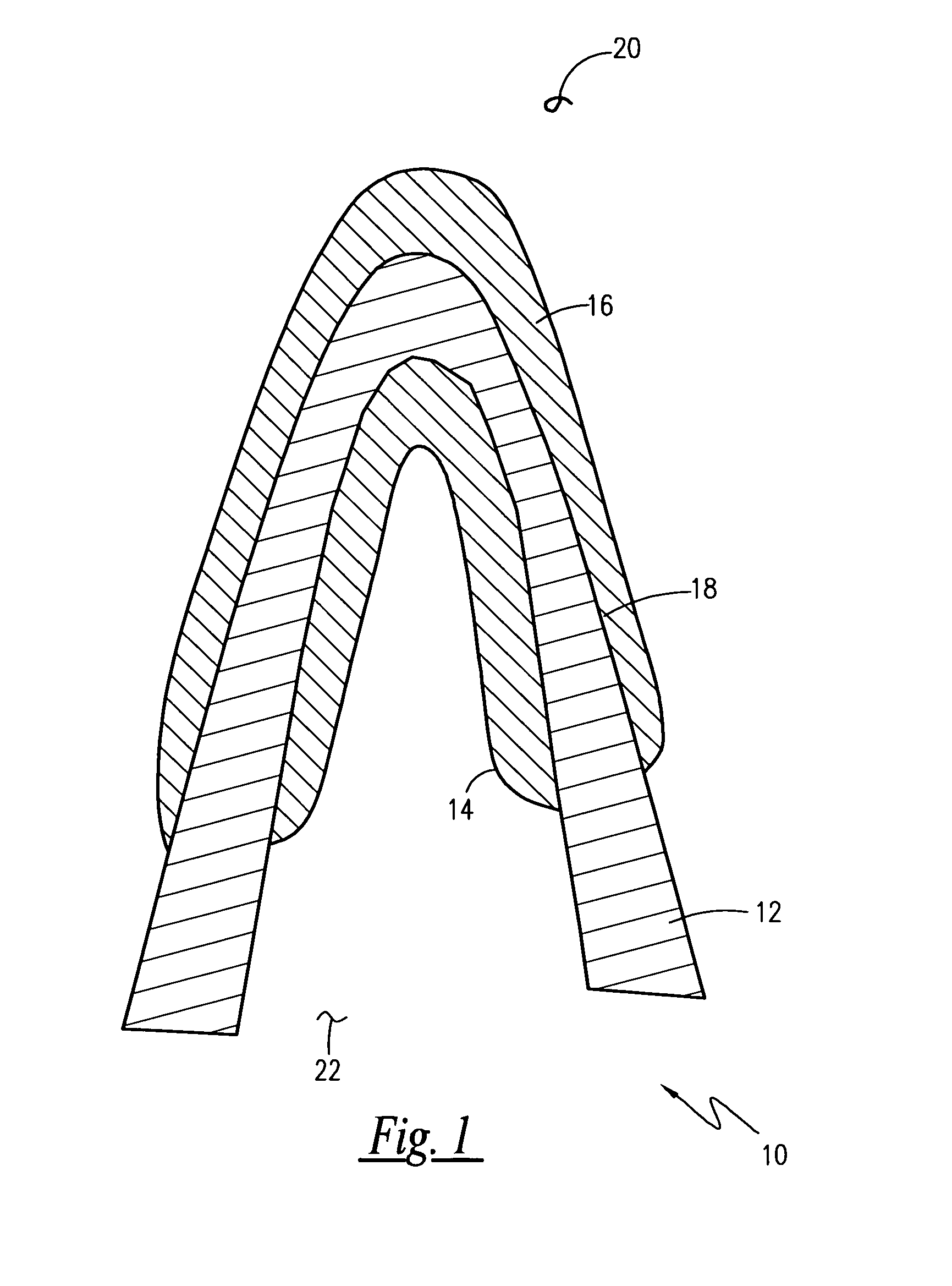 Method for improving performance and longevity of solid electrolyte gas sensor