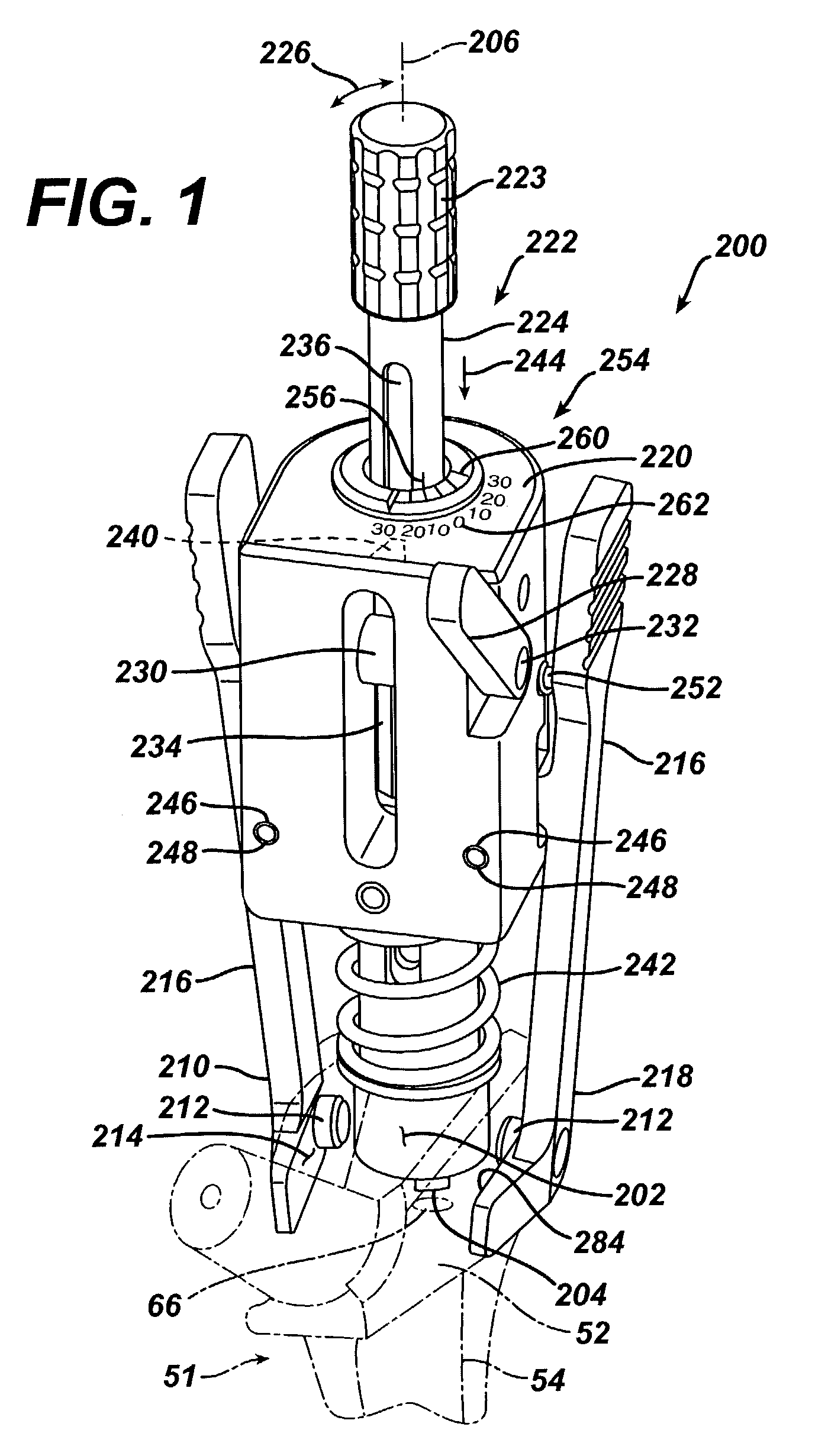 Alignment device for modular implants and method