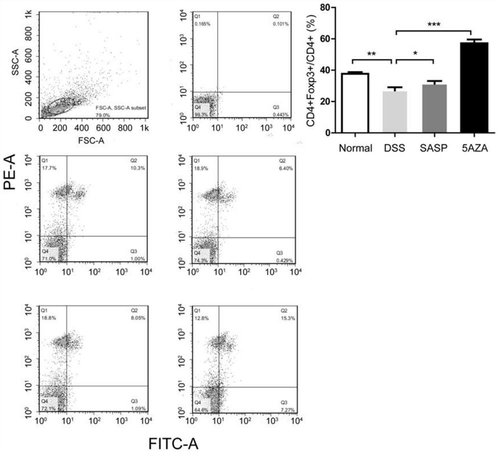 Application of decitabine in preparation of medicine for treating inflammatory bowel diseases