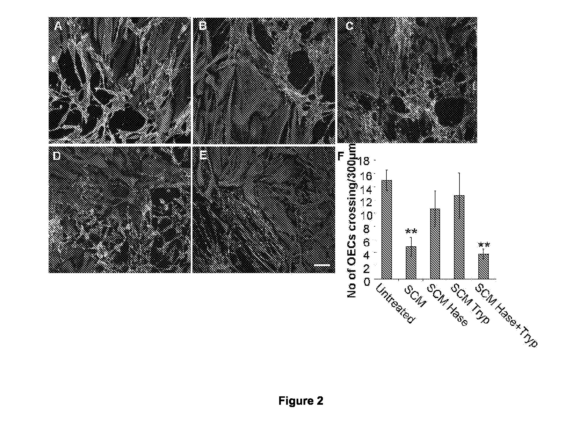 Agents for the prevention and/or treatment of central nervous system damage