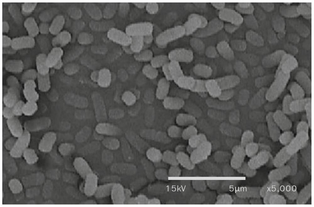 Lactobacillus plantarum and application thereof