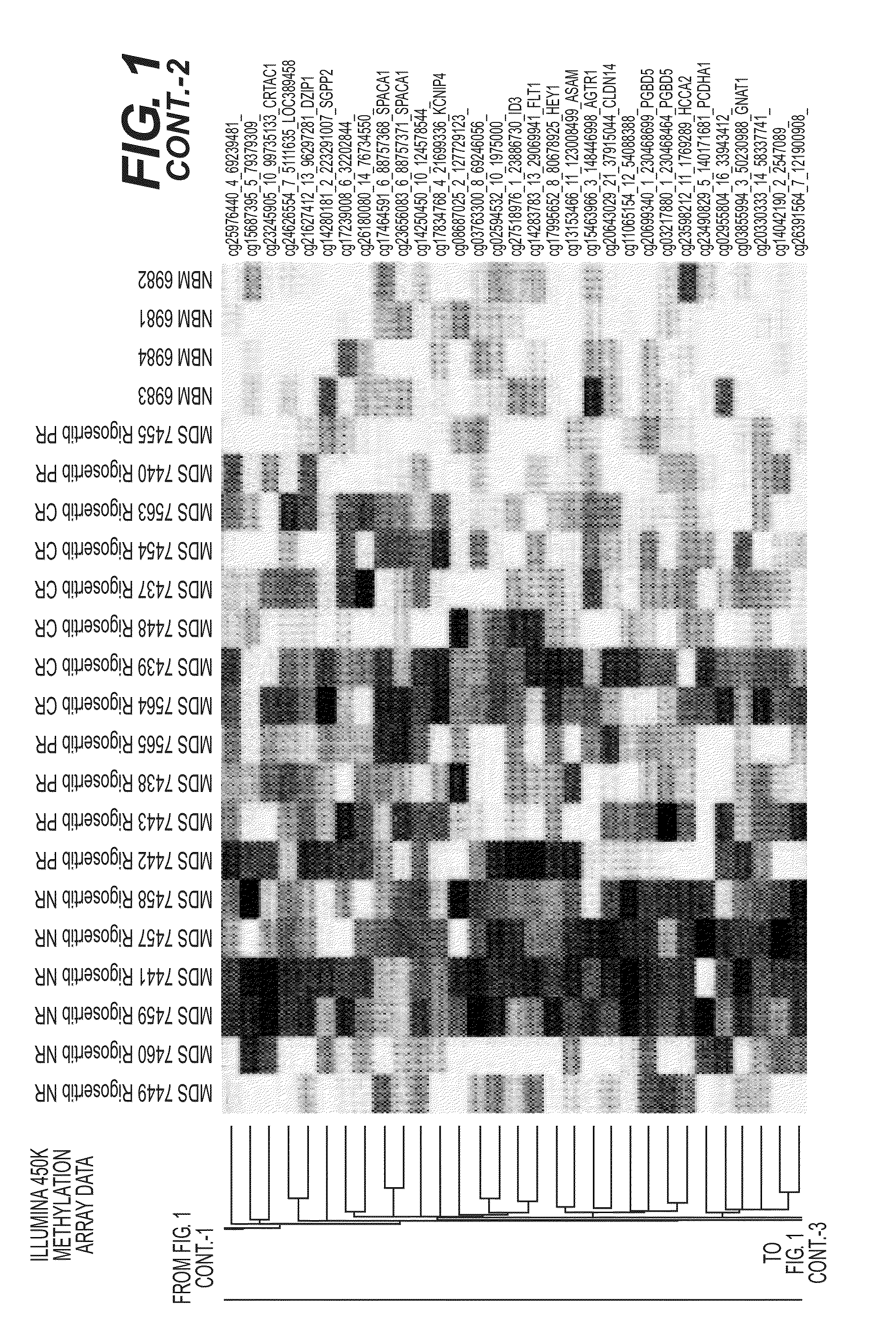 Methods and compositions for predicting therapeutic efficacy of kinase inhibitors in patients with myelodysplastic syndrome or related disorders