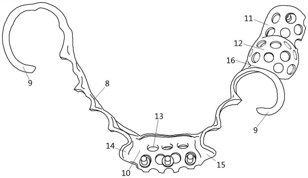 Construction method and production method of preparatory guide plate and removable partial denture bracket model