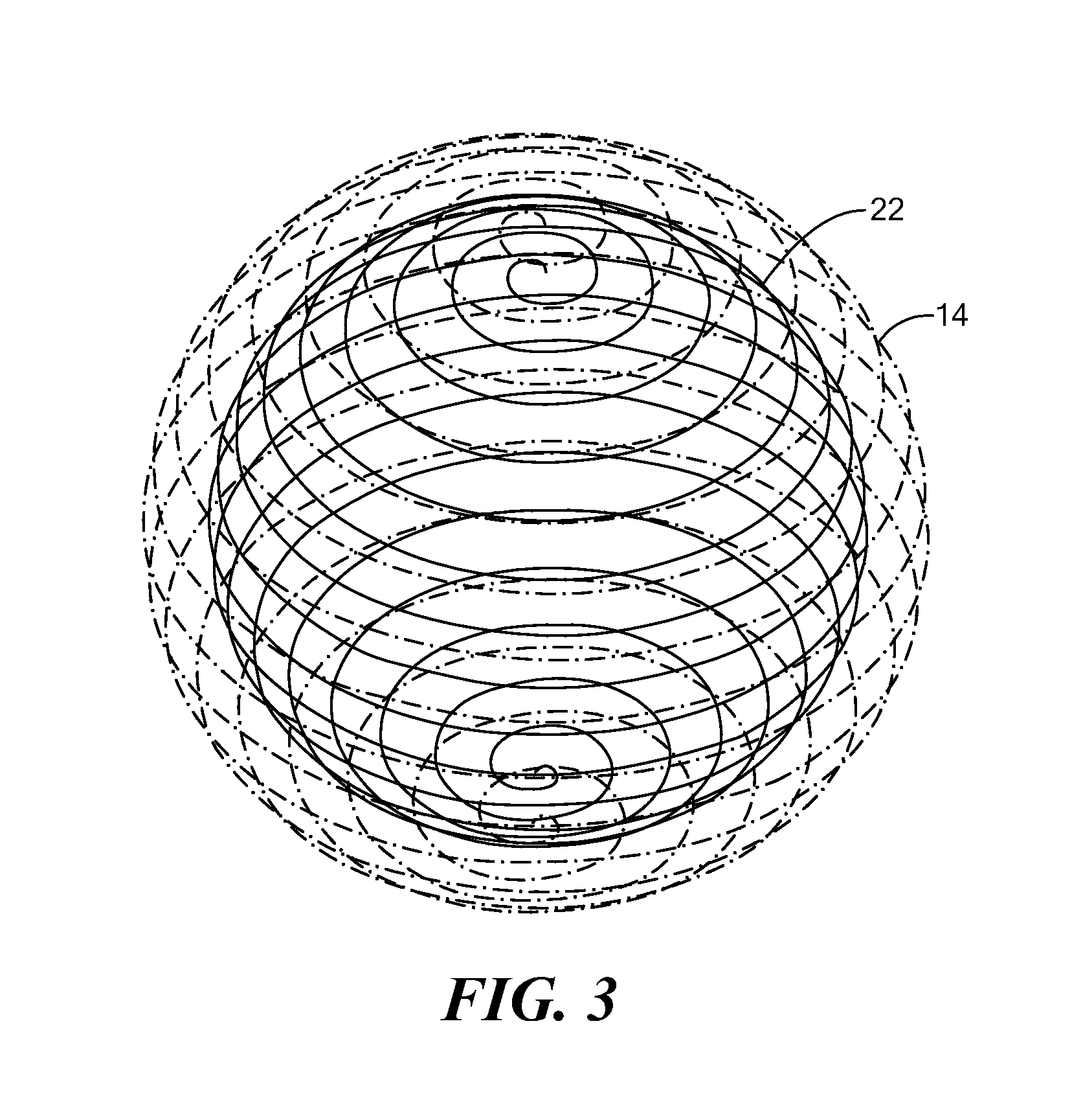 Spherical helix embolic coils for the treatment of cerebral aneurysms