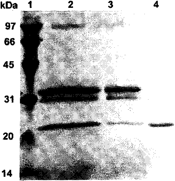 Acid xylanase XYNB, genes and application thereof