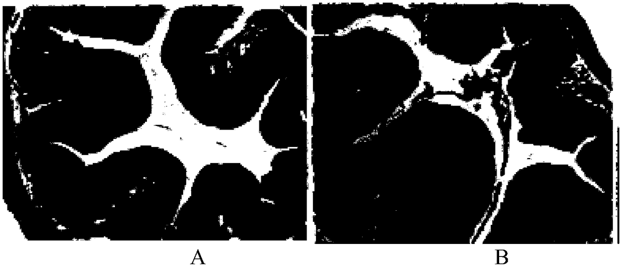 Traditional Chinese medicinal composition for treating ulcerative colitis and preparation method of traditional Chinese medicine composition