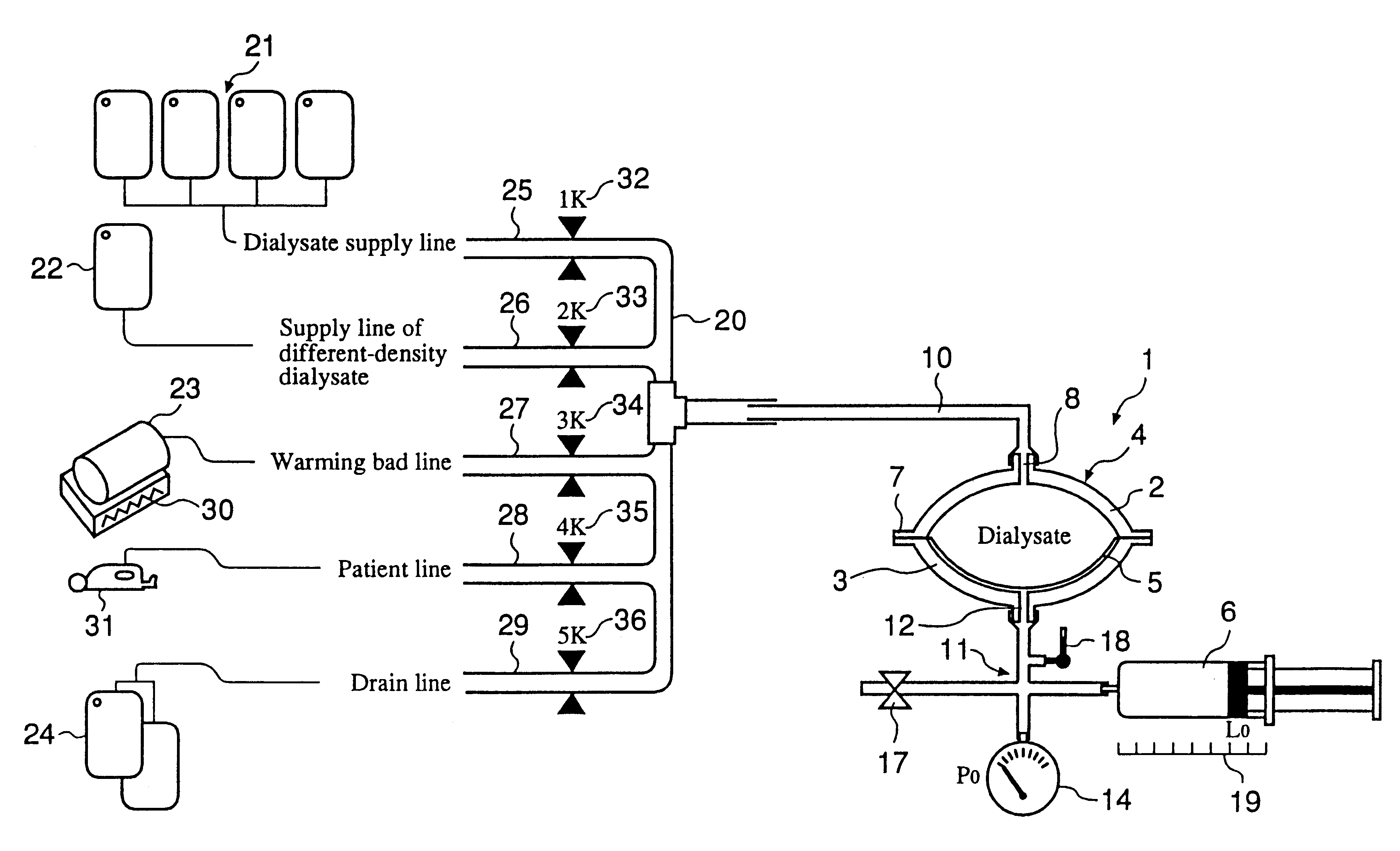 Automated solution injection-discharge system and automated peritoneal dialysis system