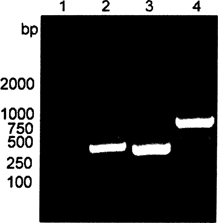 Heavy chain and light chain variable region gene of human B lymphocyte stimulation factor monoclonal antibody and its application