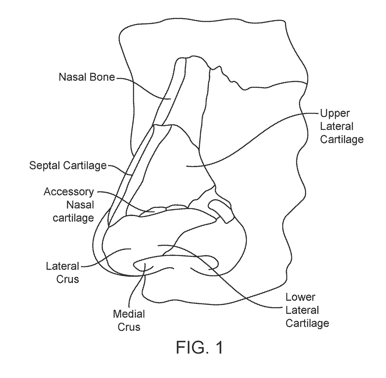 Methods and devices to treat nasal airways