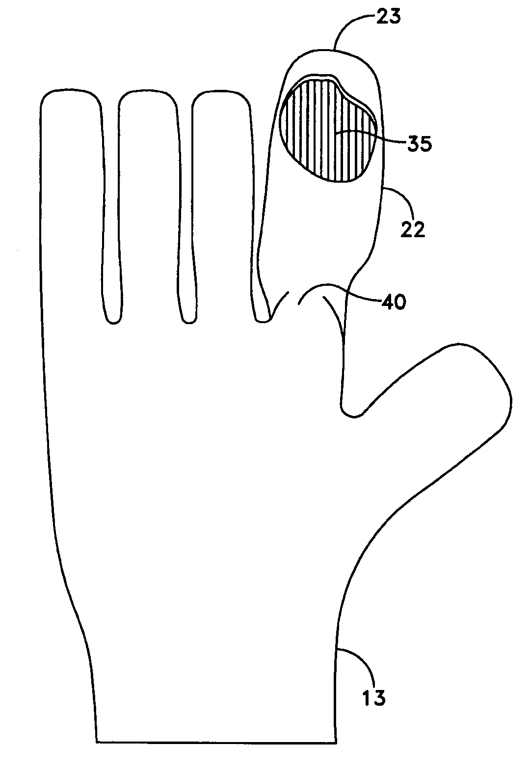 Apparatus and method for measuring the dimensions of the palpable surface of the prostate