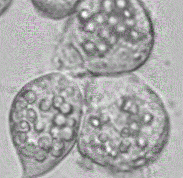 A method for preventing the inactivation of neurotoxin anntoxin