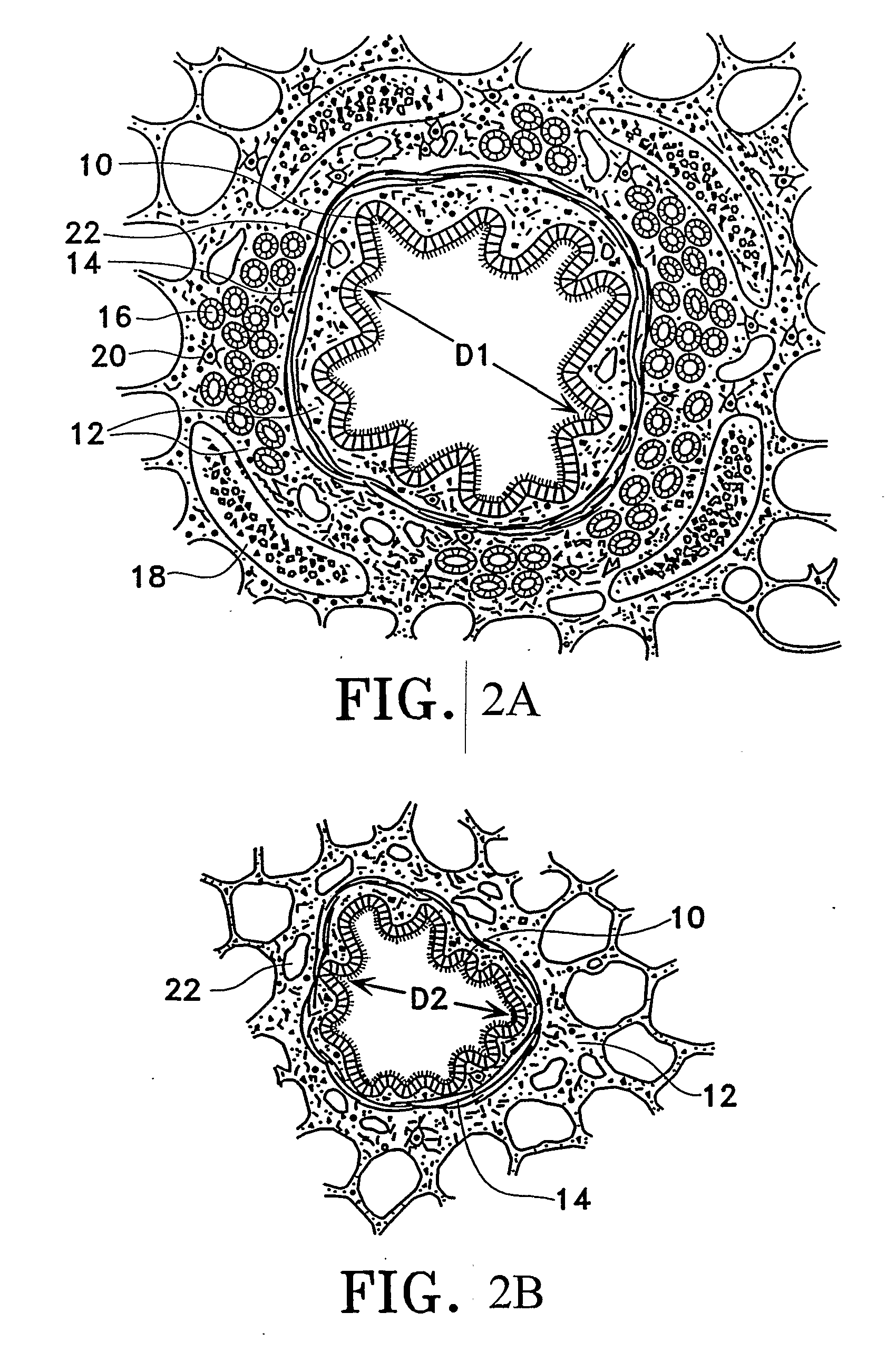 Control system and process for application of energy to airway walls and other mediums