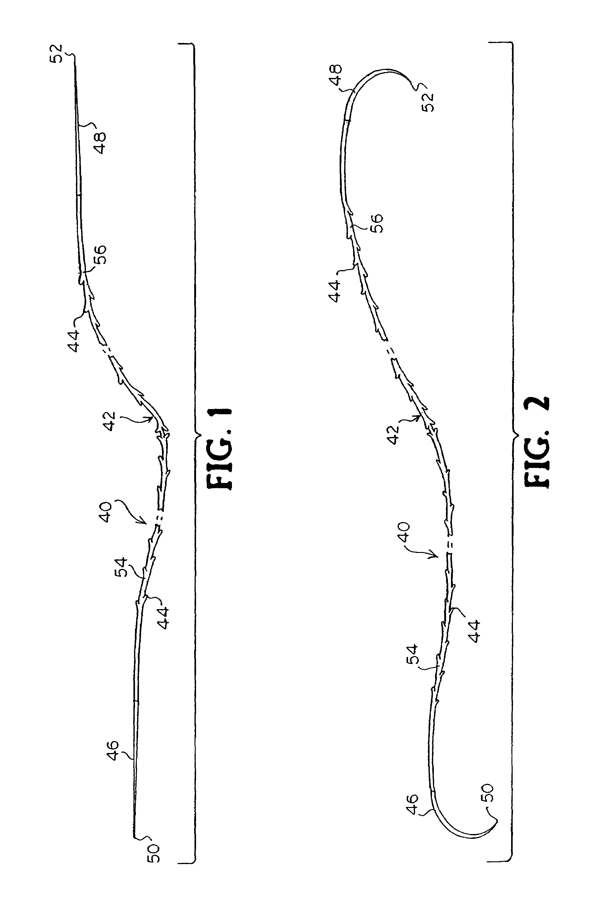 Suture method