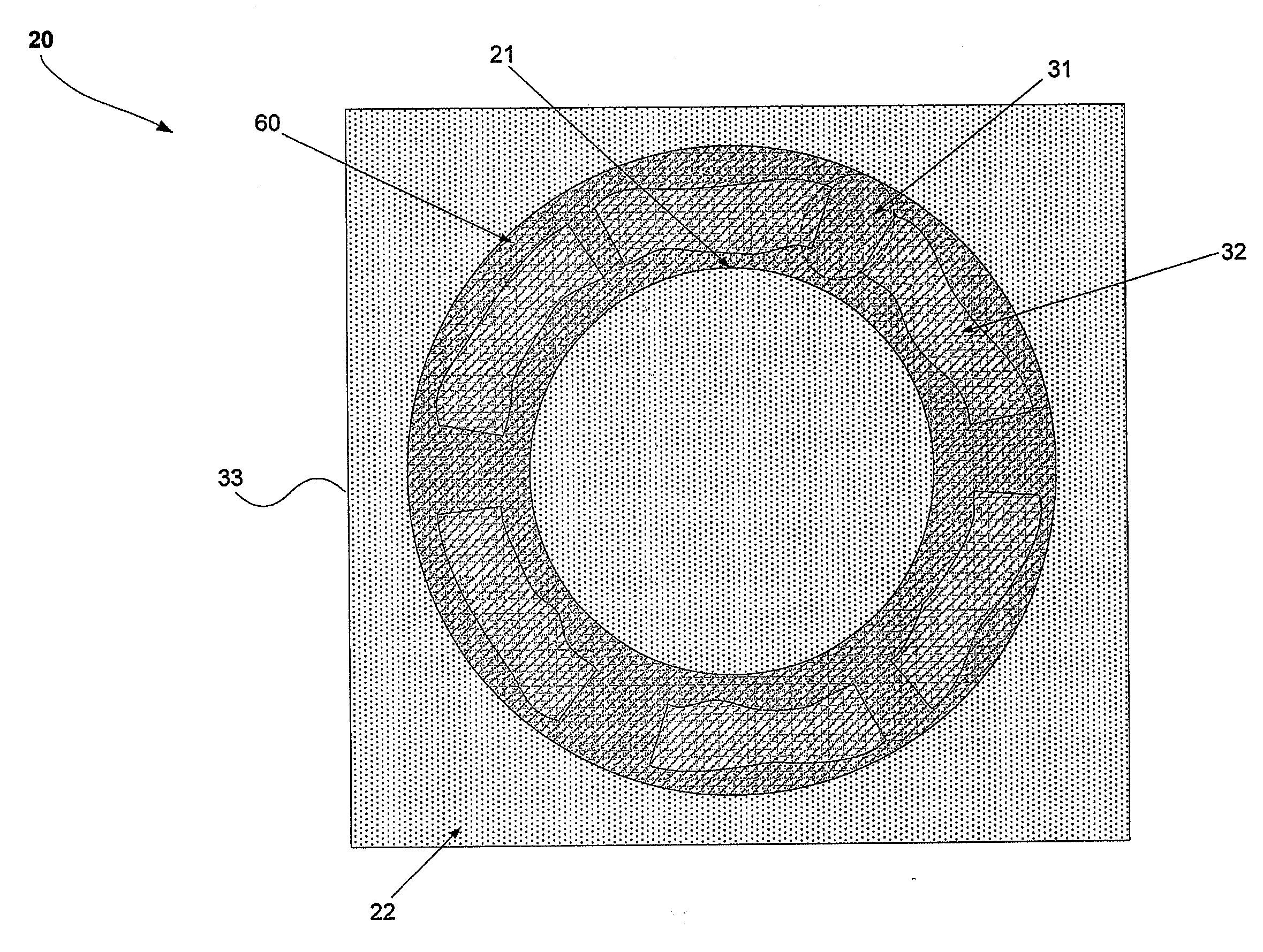 MEMS stress concentrating structure for MEMS sensors