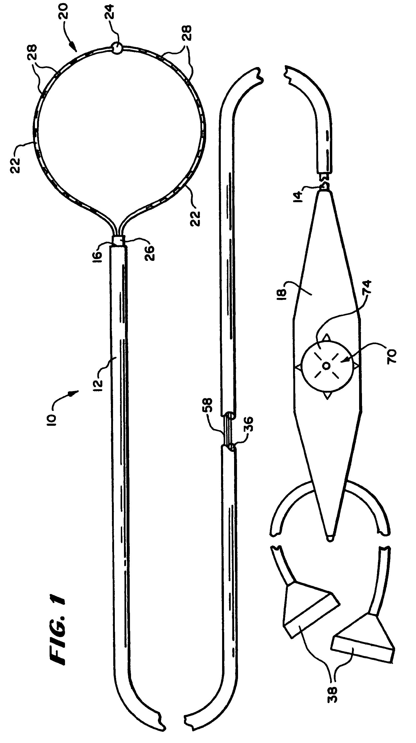 Surgical method and apparatus for positioning a diagnostic or therapeutic element within the body