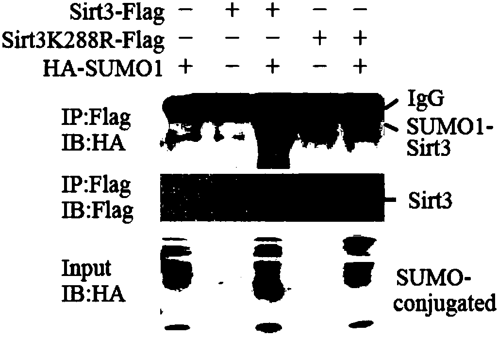 Modulation and control of SENP1 phosphorylated modified compound and SIRT3 SUMOylation modified compound and application of SENP1 phosphorylated modified compound and SIRT3 SUMOylation modified compound