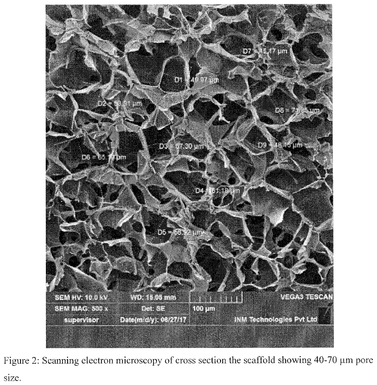 Scaffold compositions for tissue repair