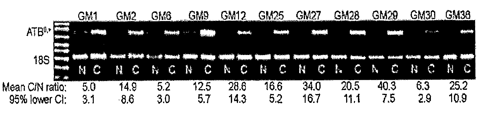 Prodrugs of Short-Chain Fatty Acids and Treatment Methods