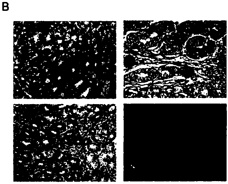 Application of MACC1-AS1 probe to preparation of diagnostic reagent for predicting clinical prognosis of gastric cancer