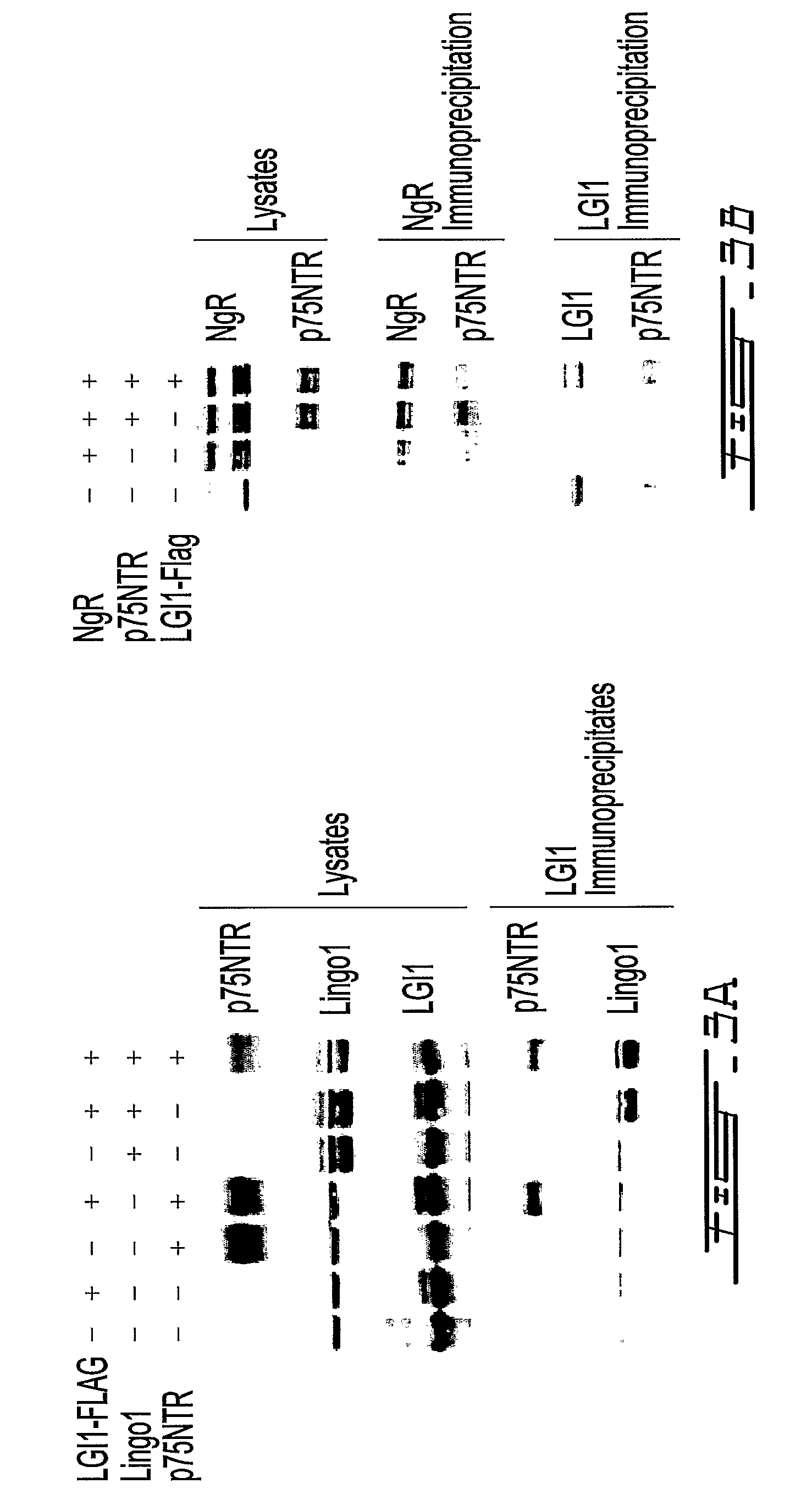 LGI, LINGO and p75NTR family members: novel modulators of neuronal growth