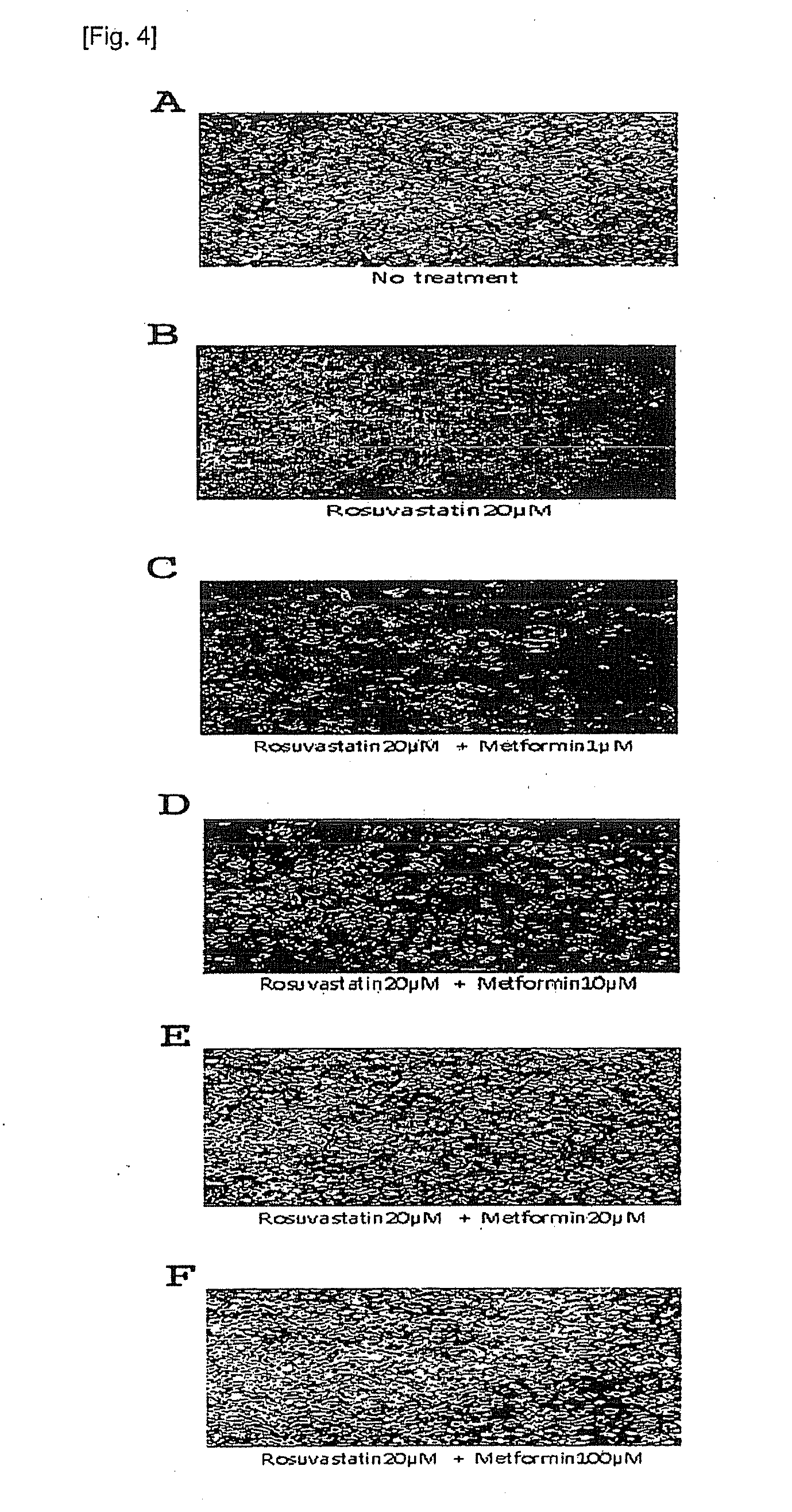 Pharmaceutical composition comprising metformin and rosuvastatin