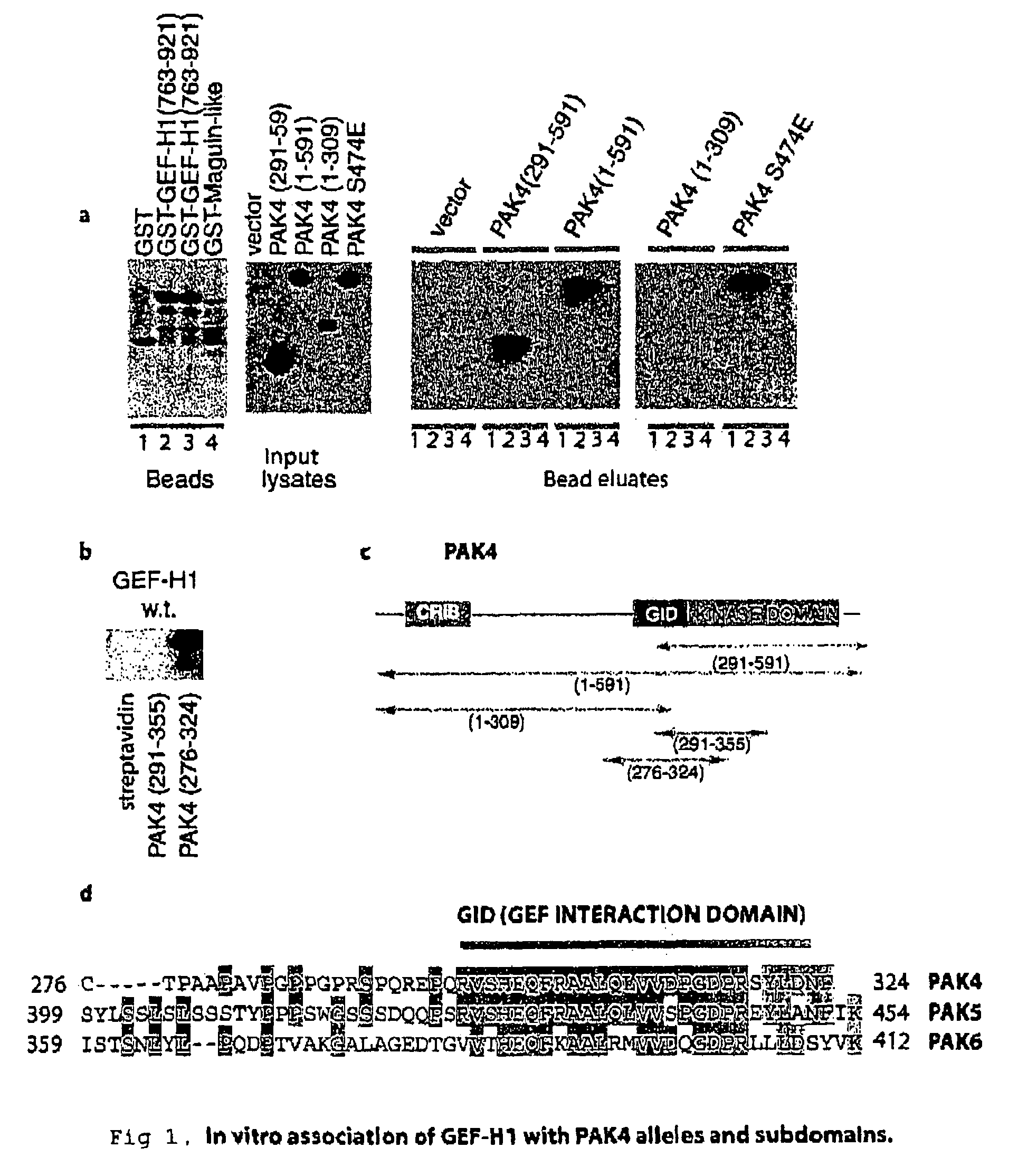 GEF-H1b: biomarkers, complexes assays and therapeutic uses thereof