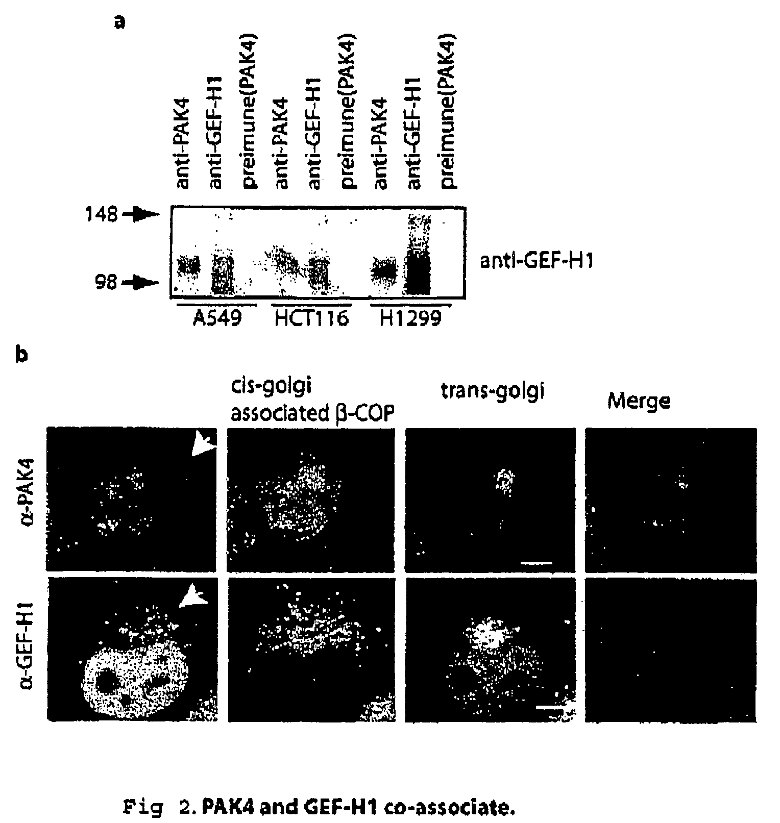 GEF-H1b: biomarkers, complexes assays and therapeutic uses thereof