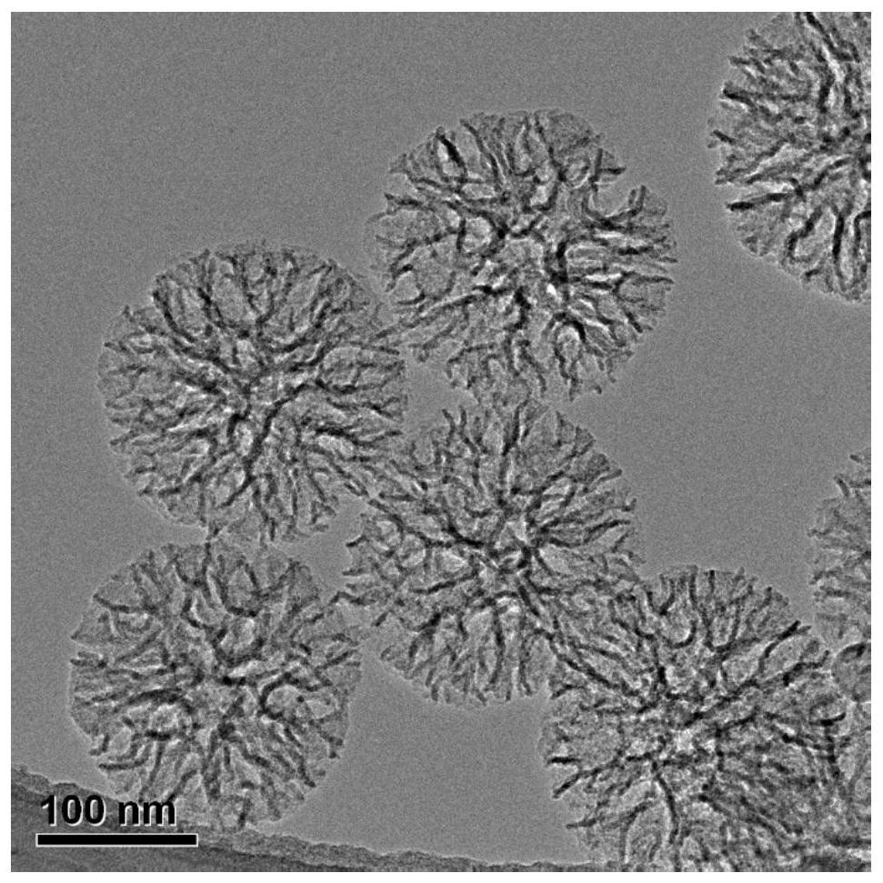 Preparation and application of dendritic mesoporous silica/iridium dioxide composite nanozyme