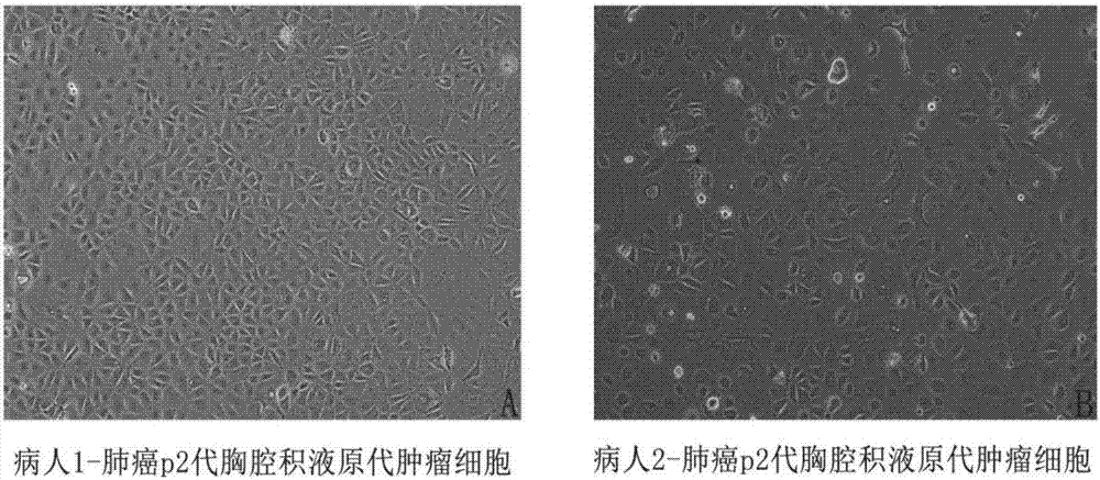 Method for utilizing malignant pleural effusion for separately culturing primary cancer cells