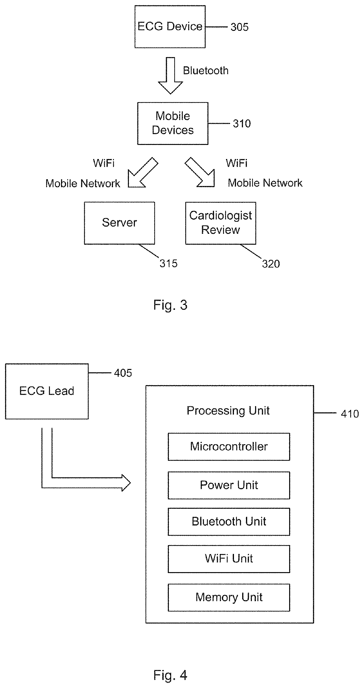 Method of detecting abnormalities in ECG signals