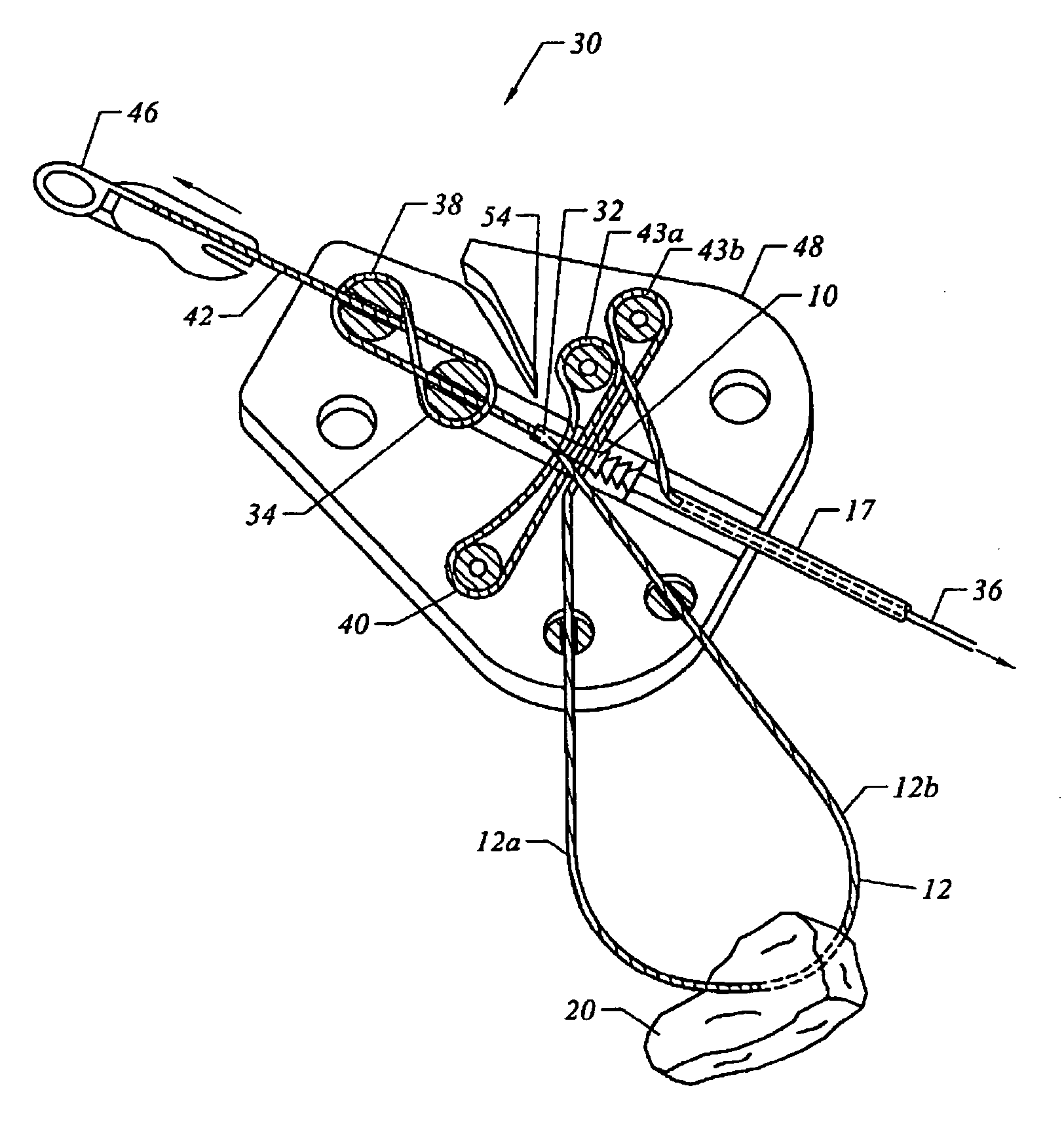 Bone anchor suture-loading system, method and apparatus