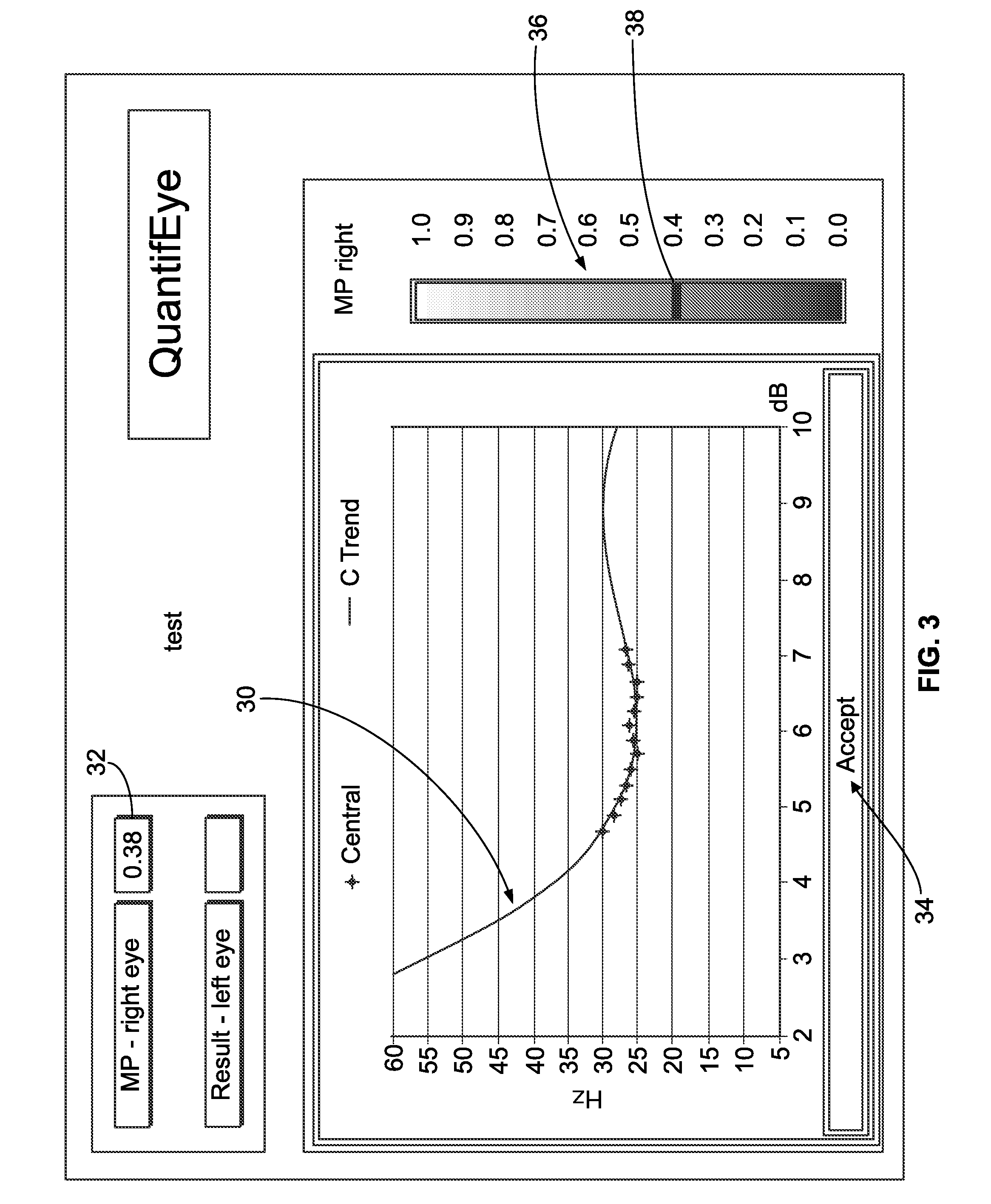 Macular Pigment Measurement Device With Data Quality Indexing Feature