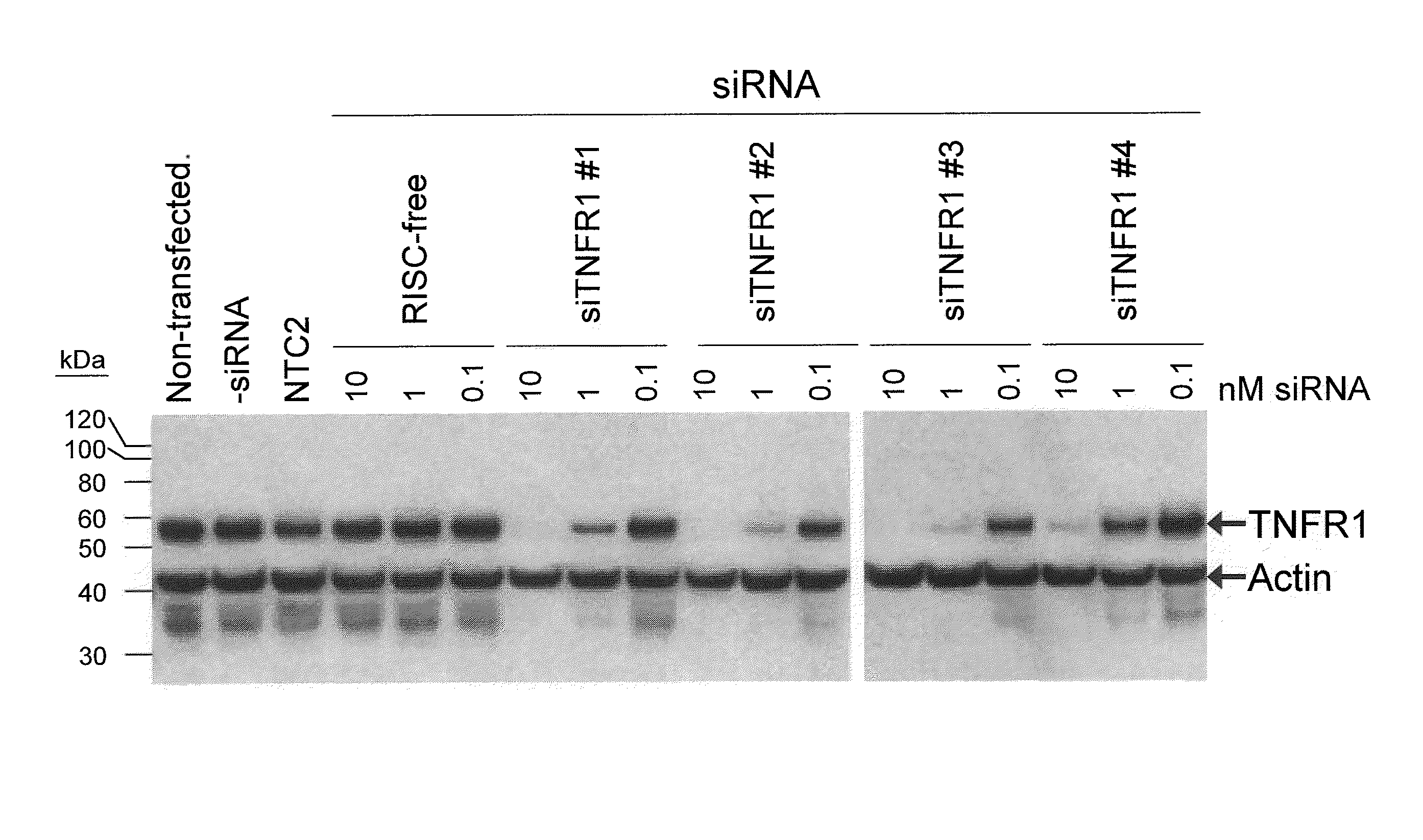 RNAi-related inhibition of TNFα signaling pathway for treatment of glaucoma