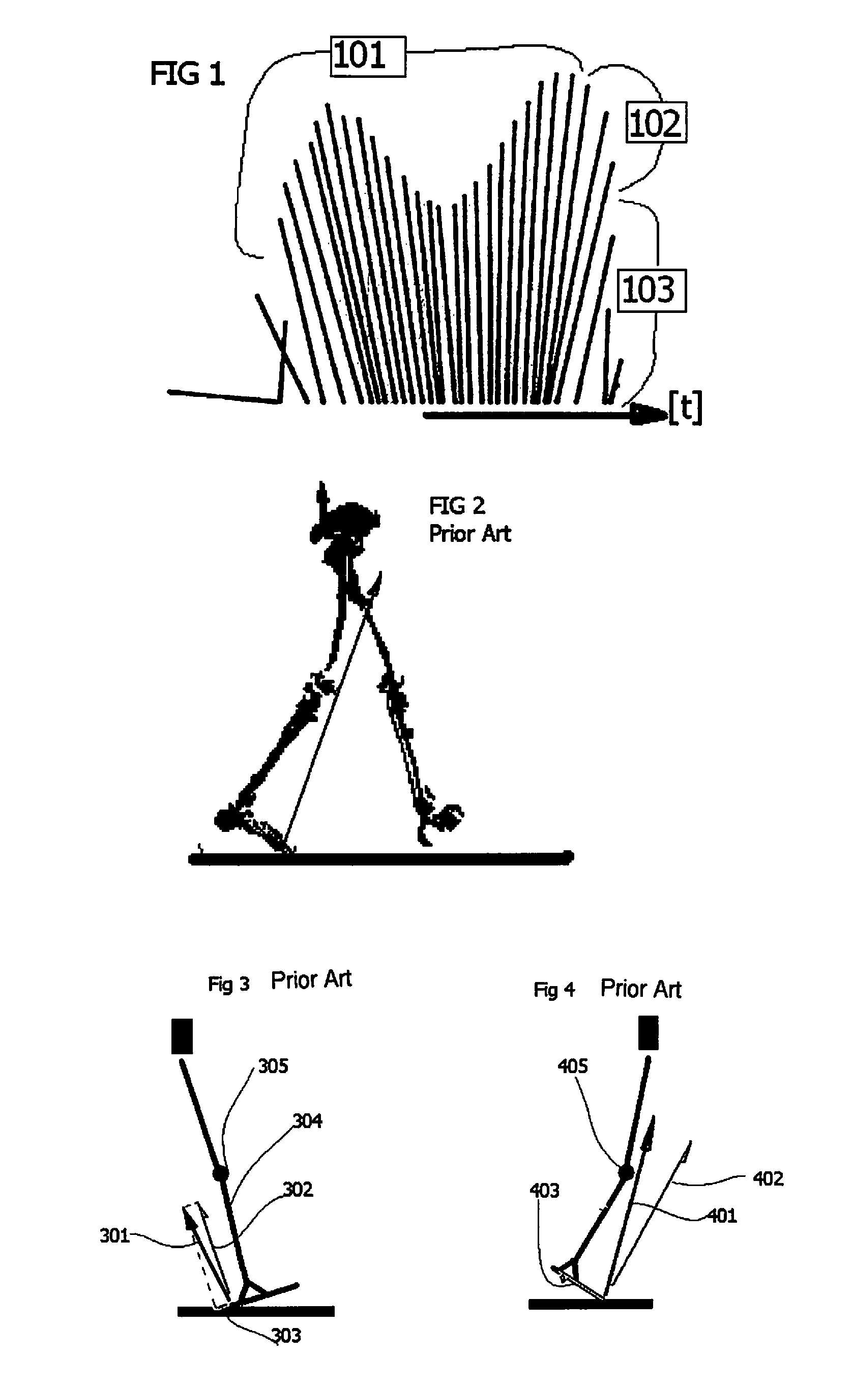 Prosthesis having movement lock