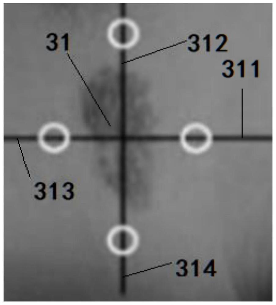 Hemangioma body color quantitative evaluation system and evaluation method