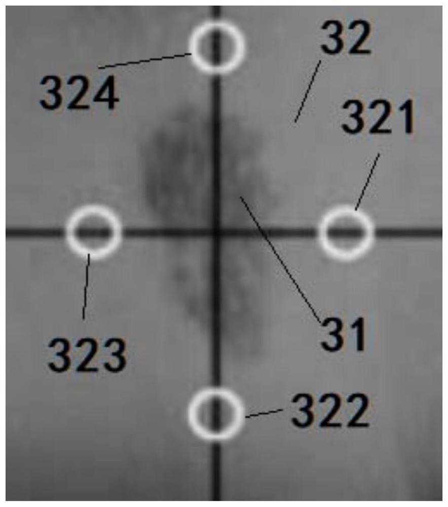 Hemangioma body color quantitative evaluation system and evaluation method