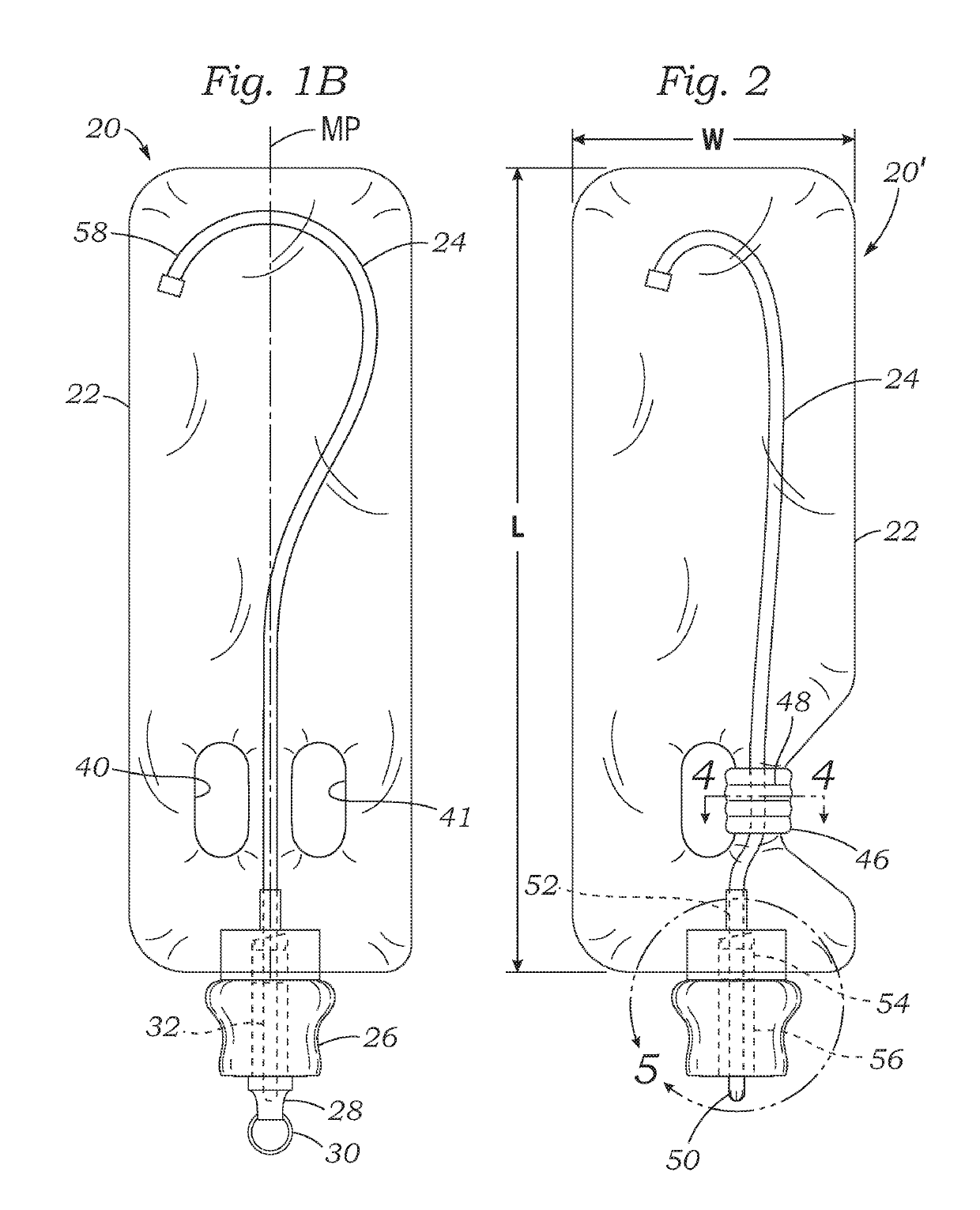 Closed system with intermittent urinary catheter feed