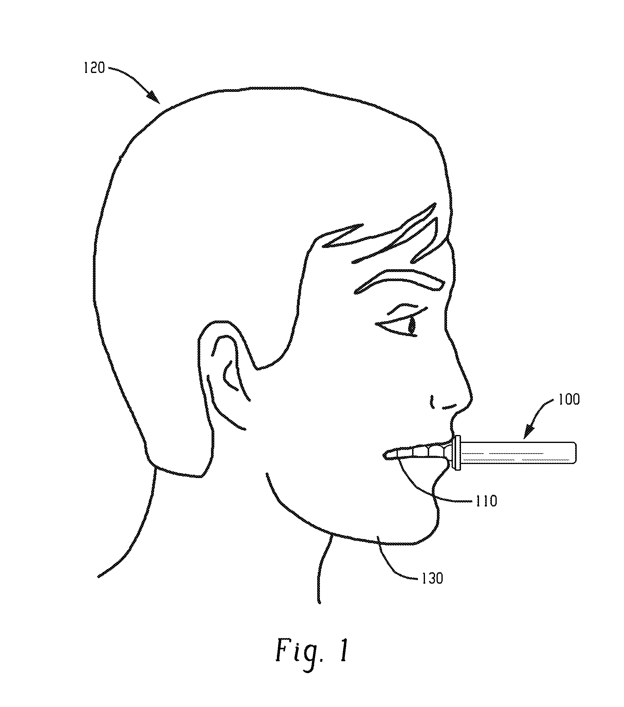 Oral function device