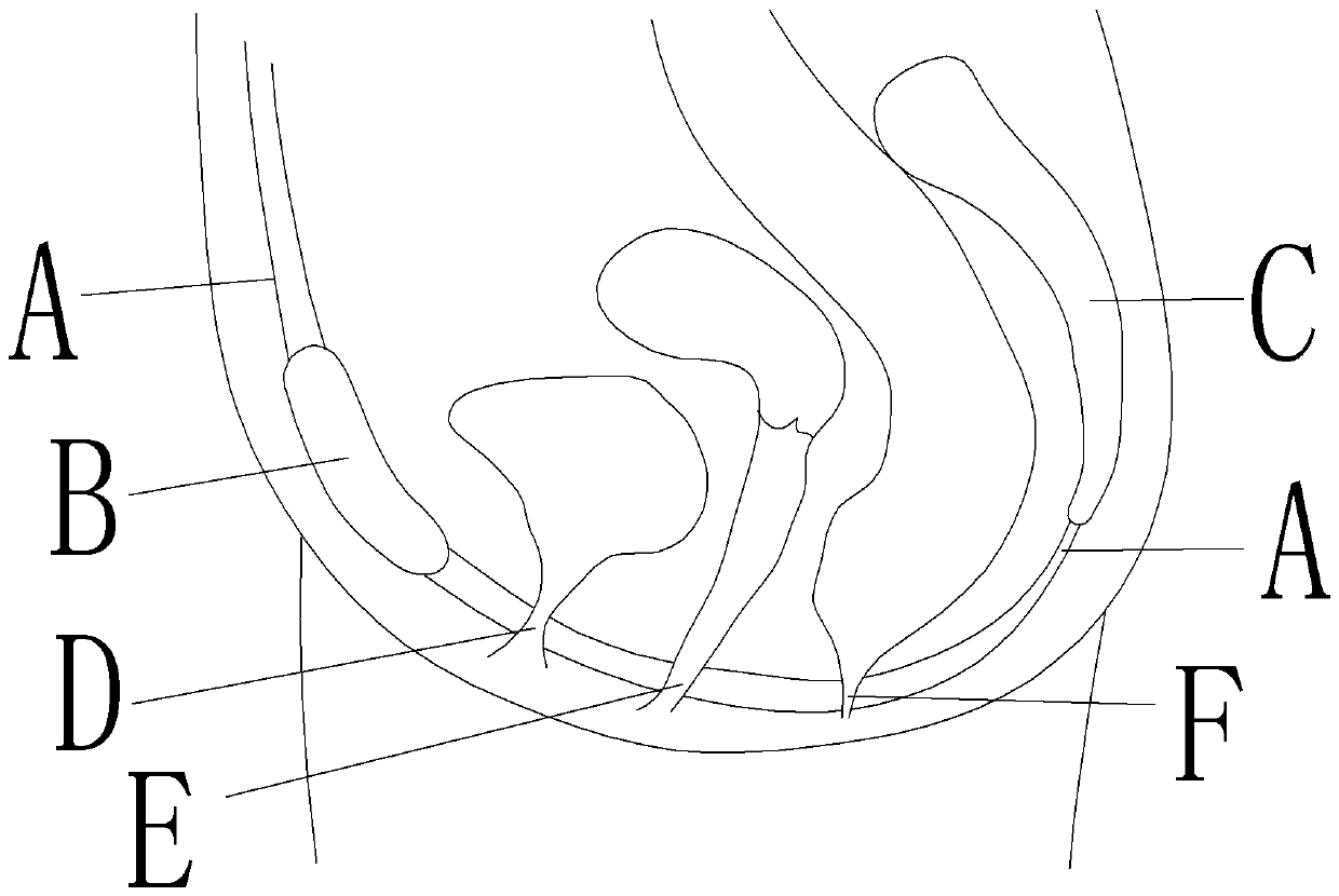 Waistband type pelvic floor muscle therapeutic apparatus