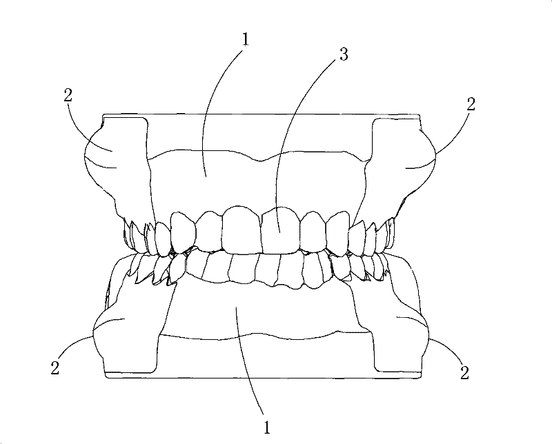 Alveolar abscess cut model