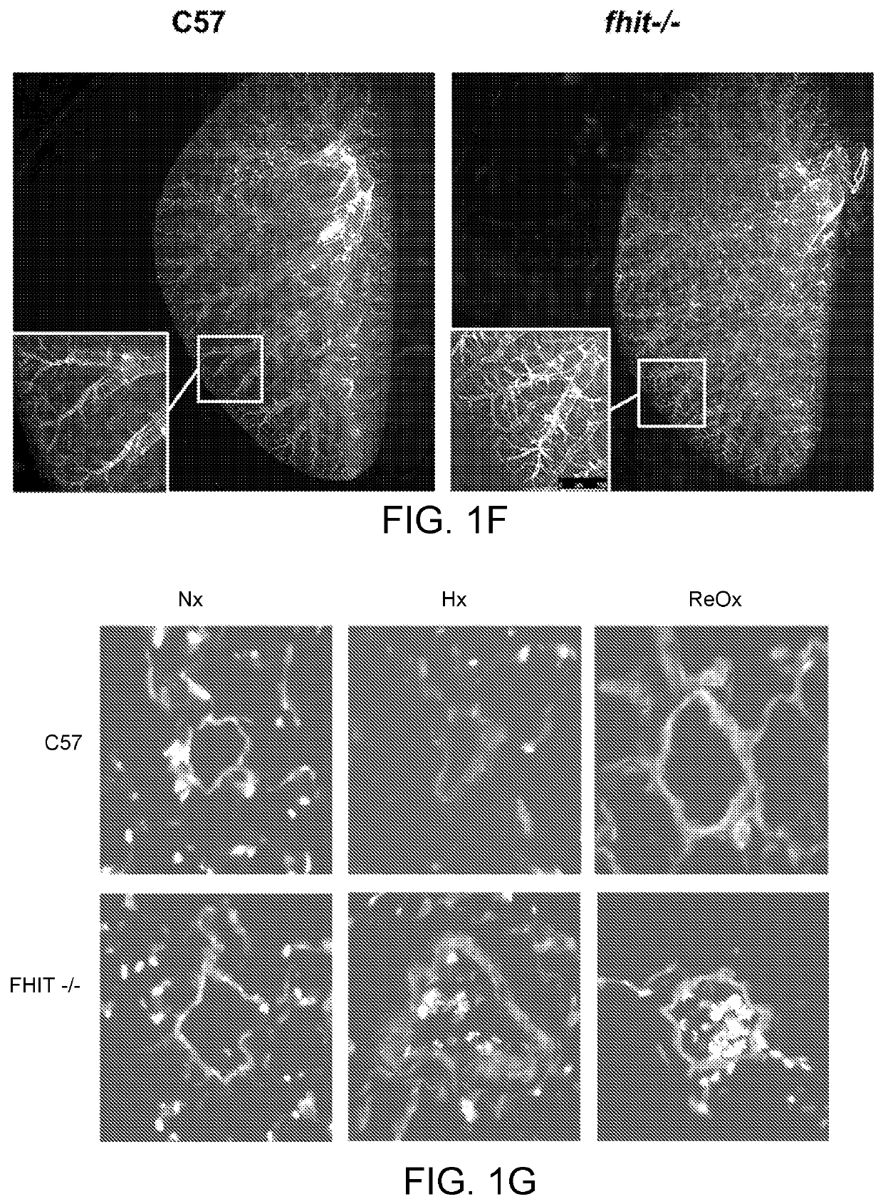 Enzastaurin and fragile histidine triad (FHIT)-increasing agents for the treatment of pulmonary hypertension