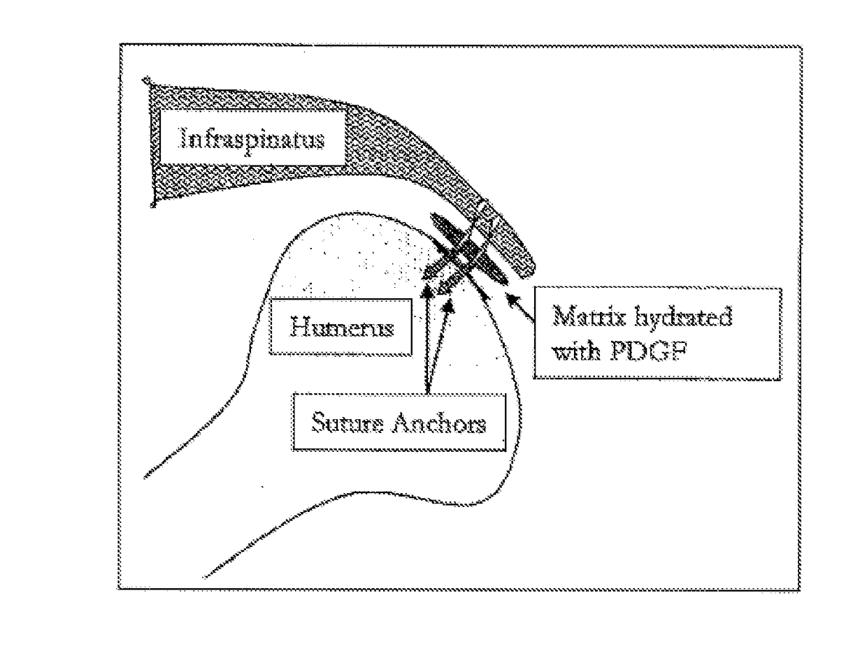 Compositions and Methods for Treating Rotator Cuff Injuries