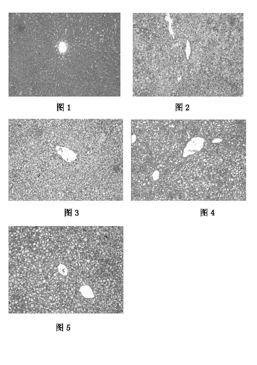 Application of Awei capsules to preparation of drugs for treating hyperlipemia and fatty liver disease