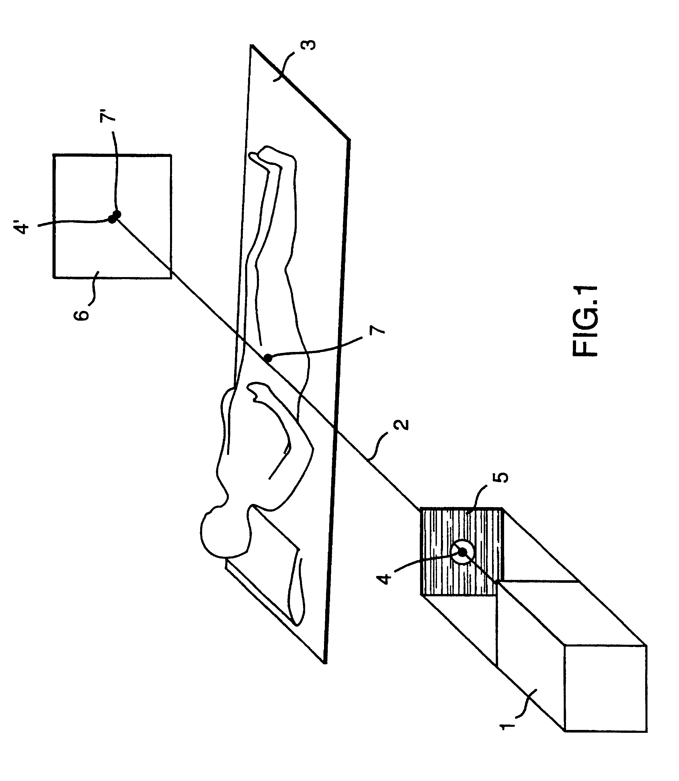 Arrangement and reference means to direct a beam in radiation therapy