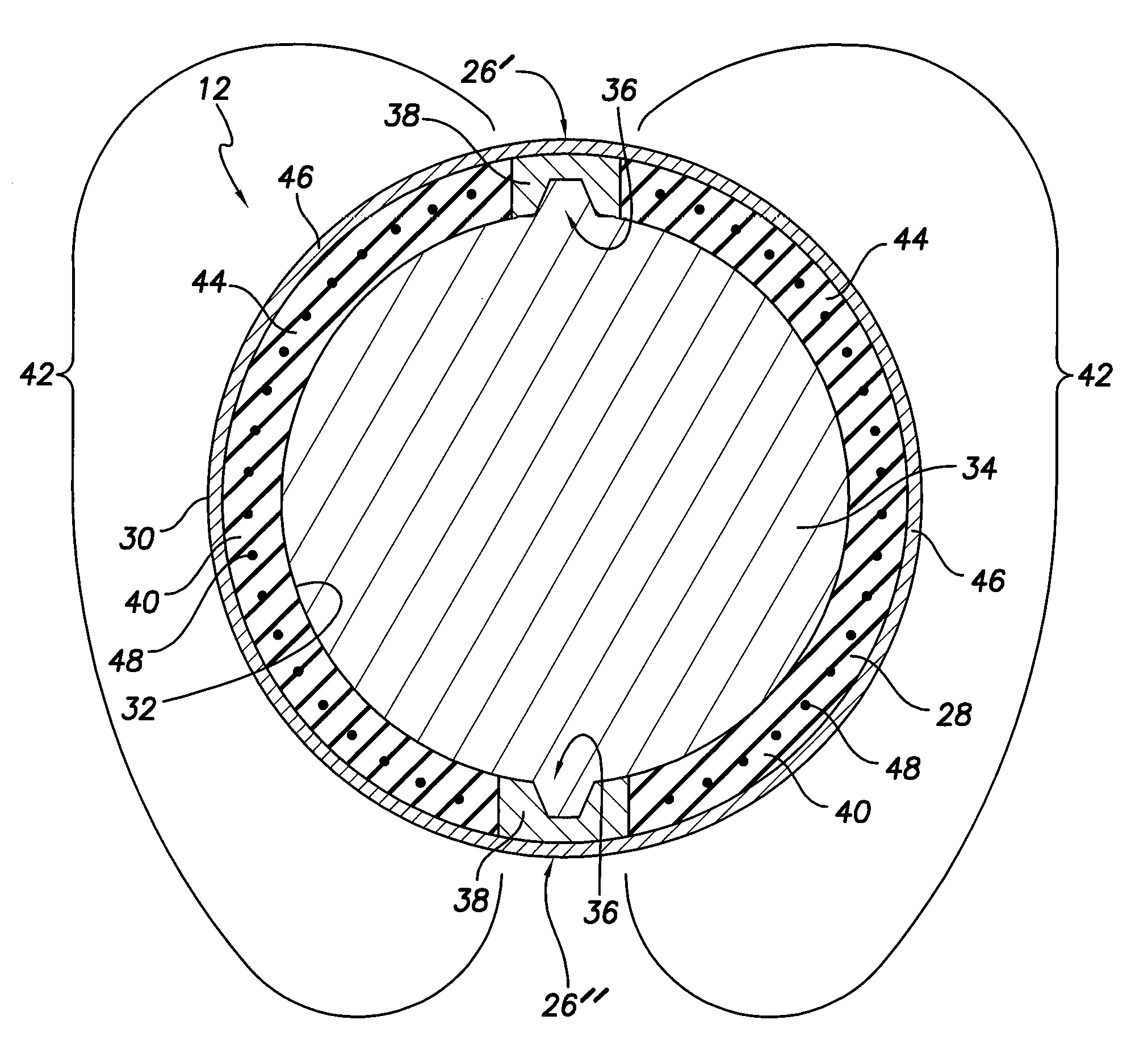 Braided peelable catheter and method of manufacture