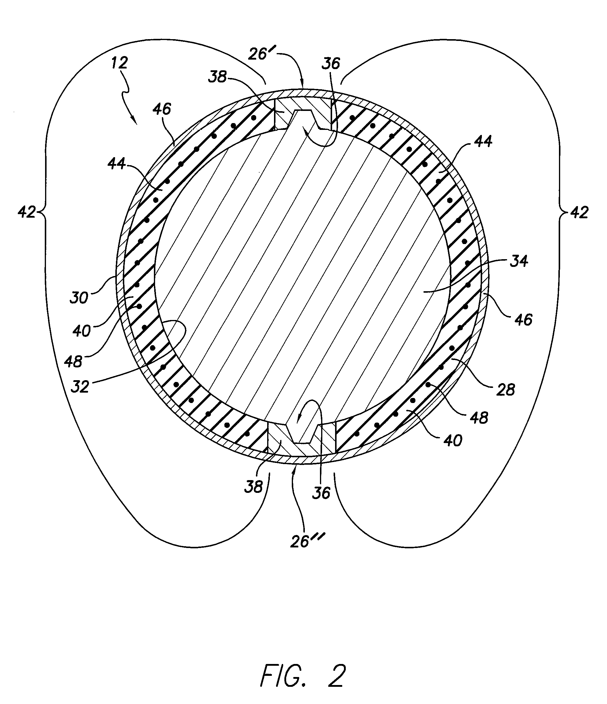Braided peelable catheter and method of manufacture