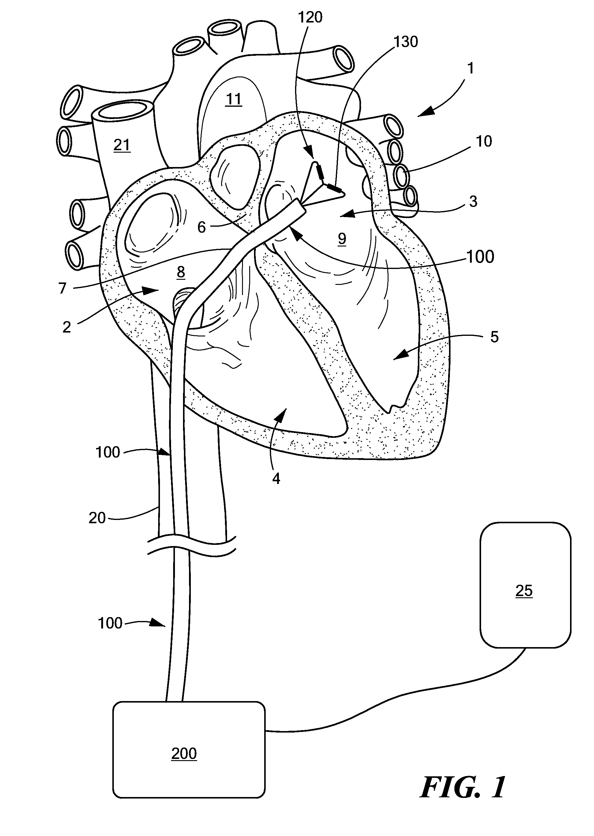 User interface for tissue ablation system