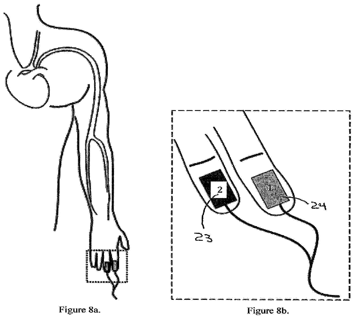 Methods and apparatus for assessing vascular health