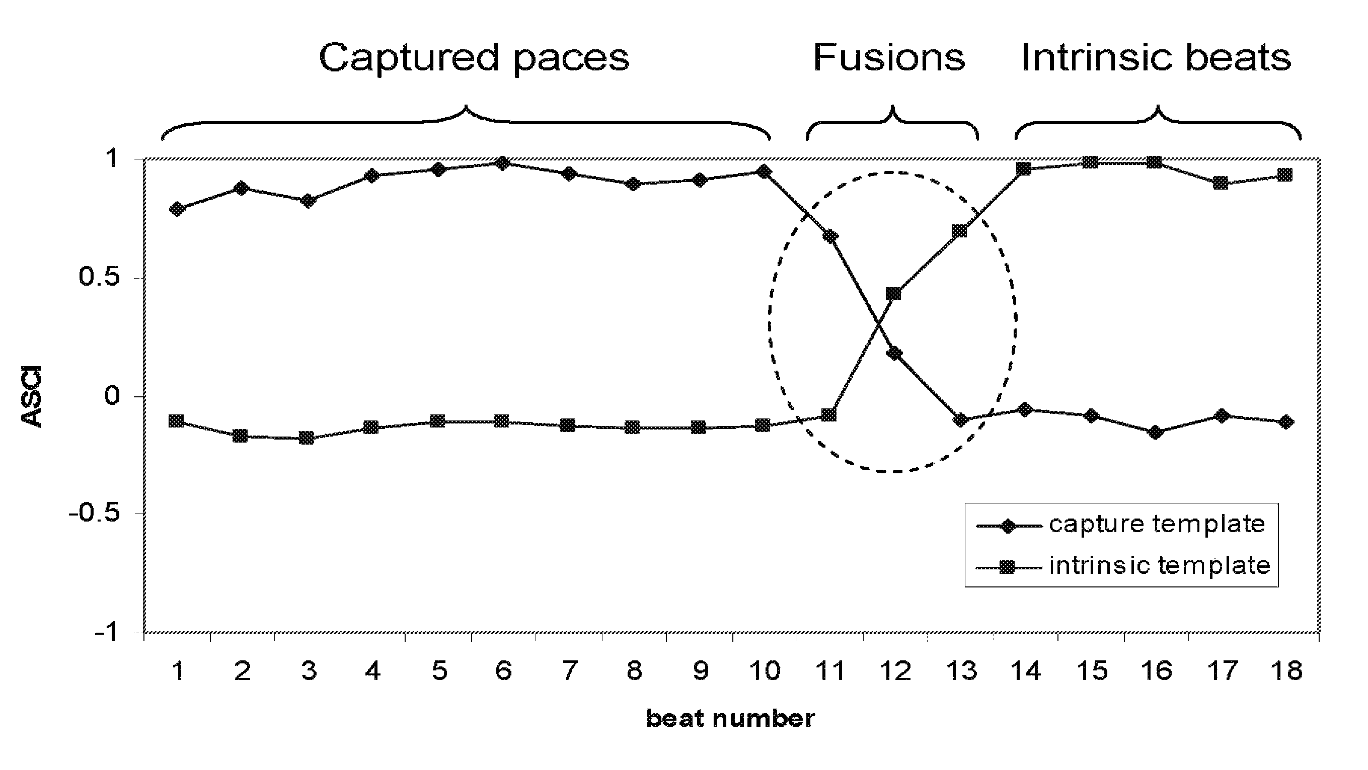 Device and method for fusion beat detection